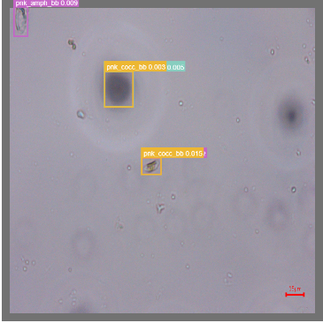 Classification Loss 지표 활용 전